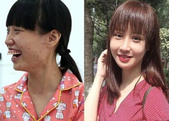 5 ca phẫu thuật khó tại bệnh viện thẩm mỹ Kangnam