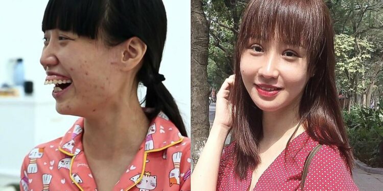 5 ca phẫu thuật khó tại bệnh viện thẩm mỹ Kangnam