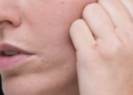 Da nhăn nheo, chảy xệ dù còn trẻ: nguyên nhân do đâu?