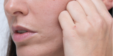 Da nhăn nheo, chảy xệ dù còn trẻ: nguyên nhân do đâu?