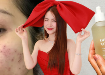 Nếu không thể uống nước diếp cá giống Hoà Minzy, chị em dùng mỹ phẩm chứa thành phần này cũng “okelah” lắm