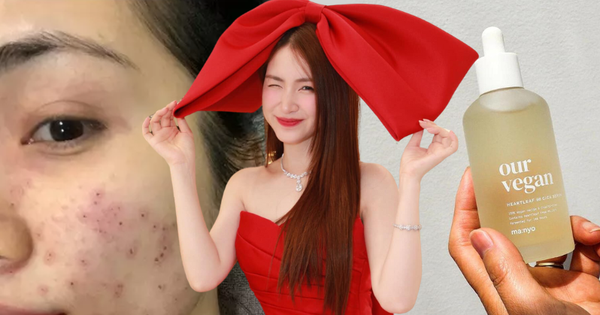 Nếu không thể uống nước diếp cá giống Hoà Minzy, chị em dùng mỹ phẩm chứa thành phần này cũng “okelah” lắm