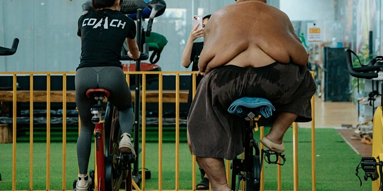 Da thừa chảy xệ sau khi trút bỏ 60 kg mỡ thừa