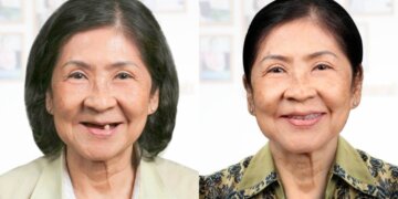 4 điểm nhấn khi cấy ghép Implant tại Dr. Care