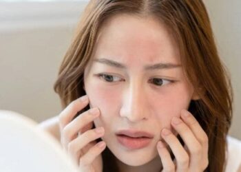 Cách chăm sóc da nhạy cảm vào mùa hè