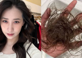 Kiếp nạn của Kiều Ly Phạm: Tóc rụng cả búi chỉ vì “trót dại” tẩy nối chân, nuôi mãi vẫn thấy vô vọng