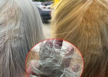 Kiếp nạn khi tẩy tóc: Làm hết 8.5 triệu, vẫn phải mua thêm bộ tóc giả về đội vì tóc rụng gần hết