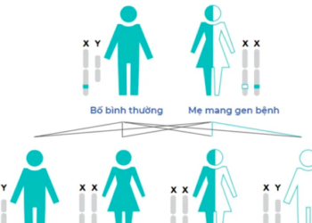 Con leo cầu thang hay ngã, bố mẹ bàng hoàng khi biết nguyên nhân