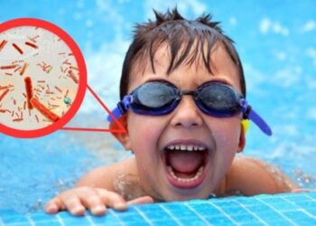 Bác sĩ hướng dẫn cách phòng tránh viêm tai khi bơi lội trong ngày hè