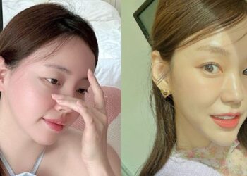 Bác sĩ khuyên dùng 5 sản phẩm chăm sóc da bình dân nhưng hiệu quả từ dưỡng sáng da đến chống lão hóa