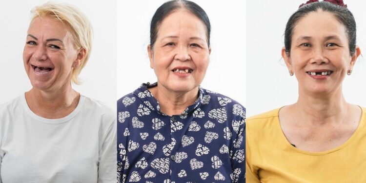 Nha khoa Plan cấy implant miễn phí cho năm người khó khăn