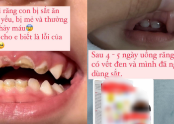Nghe bác sĩ TikTok cho uống thứ này nghi gây hại răng của con, mẹ bỉm chất vấn “lỗi của ai”, dân mạng tranh cãi