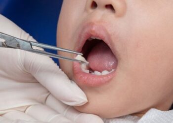 Chiếc răng sữa rất đặc biệt