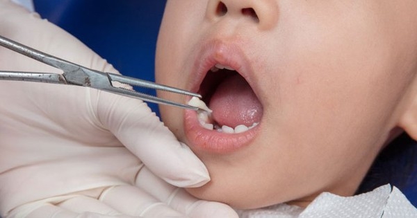 Chiếc răng sữa rất đặc biệt