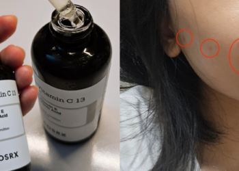 Da nhạy cảm và nhiều thâm mụn, mình đã tìm được loại serum vitamin C thấm nhanh và hiệu quả làm sáng khá ổn
