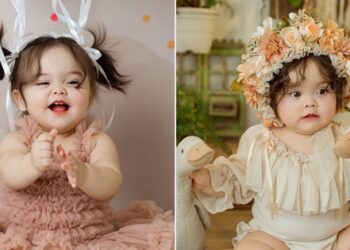 Từng mắc hội chứng lạ khi mới sinh, bé gái 1 tuổi ngày càng nổi tiếng trên MXH nhờ khuôn mặt đáng yêu như thiên thần