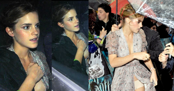 Emma Watson gặp sự cố trang phục nhớ đời với váy xẻ sâu tới rốn